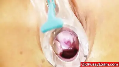 Ellen's Mature Pussy Exam