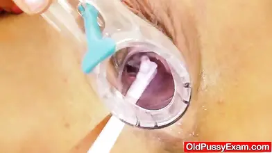 Ellen's Mature Pussy Exam